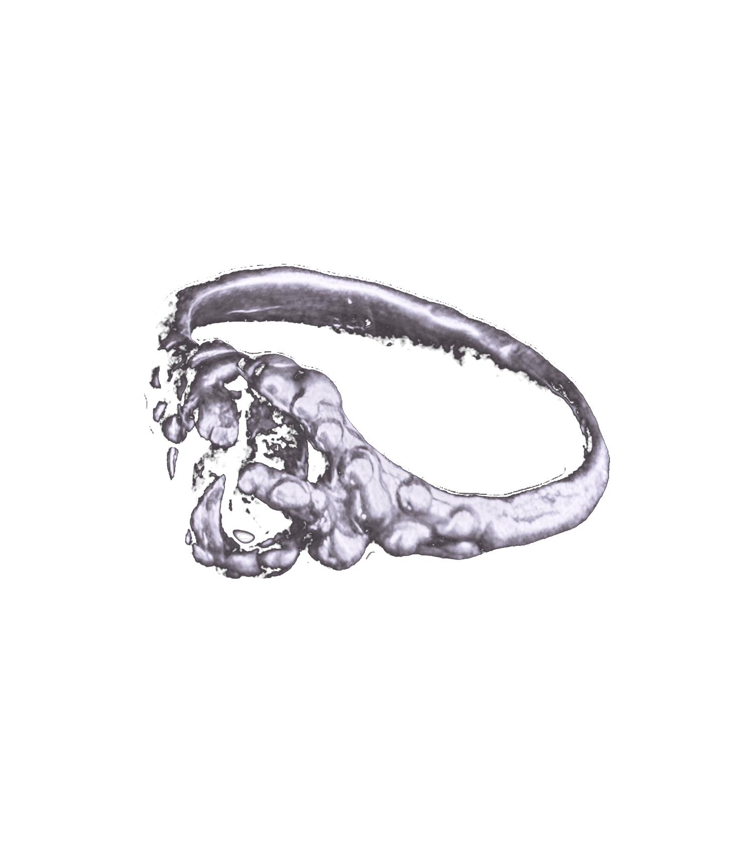 Bramble ring